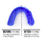 Sisu 3D Mouthguard, Hot Pink - 2.0Mm Thin - For Athletes Over 5    Tall - Pre-Formed For Custom-Molded Fit - Remoldable Up To 20