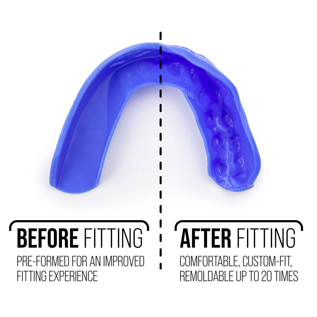 Sisu 3D Mouthguard, Charcoal Black With Case - 2.0Mm Thin - For Athletes Over 5    Tall - Pre-Formed For Custom-Molded Fit - Rem