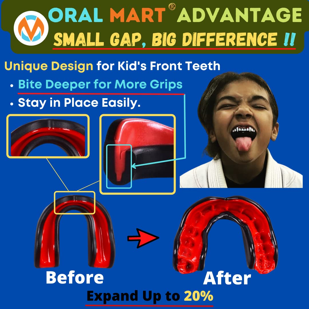 Oral Mart Blackwhite Youth Mouth Guard For Kids - Youth Mouthguard For Karate, Flag Football, Martial Arts, Taekwondo, Boxing, F